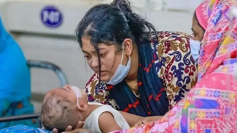 হাম উপসর্গে প্রাণহানি পৌঁছালো ৮৮৮ জনে, নিশ্চিত হামে ৯৯