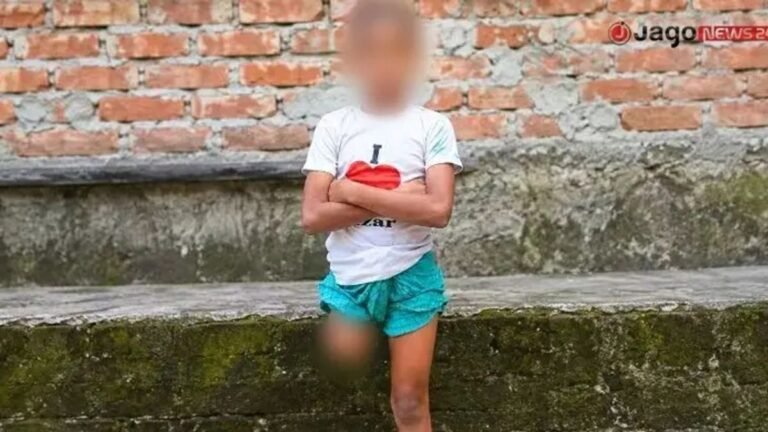 অবুঝ রায়হানের পা কেটে বানানো হয় ‘ভিক্ষার মেশিন’