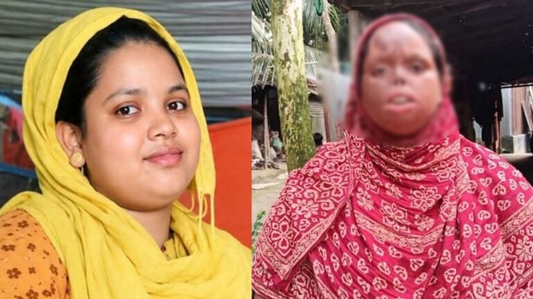 প্রেমের বিয়ের ১০ বছর পর পোড়া মুখে বিচ্ছেদের ক্ষত