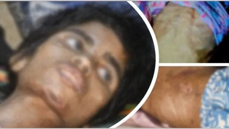 বাথরুমে বন্দি রাখা হতো শিশু তানিয়াকে, নির্যাতনে শরীরে পচন